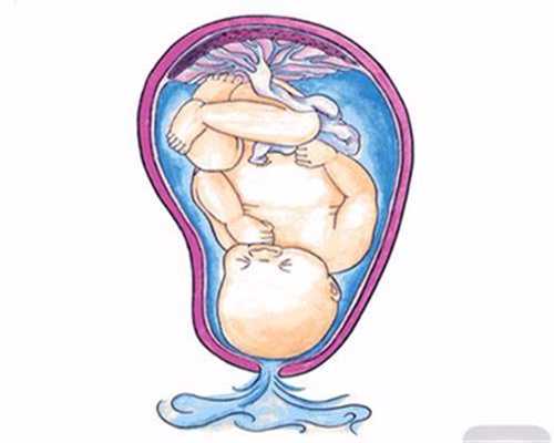 代孕8个月胎盘早剥要小心_正规捐卵要求